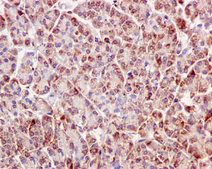 Immunohistochemistry (Formalin/PFA-fixed paraffin-embedded sections) - Anti-IGFBP7 antibody [EPR11912(B)] - BSA and Azide free (AB202765)
