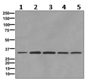 Western blot - Anti-IGFBP7 antibody [EPR11913(B)] (AB170932)