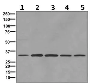 Western blot - Anti-IGFBP7 antibody [EPR11913(B)] (AB170932)