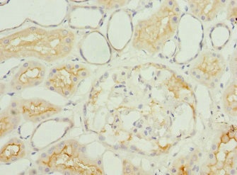 Immunohistochemistry (Formalin/PFA-fixed paraffin-embedded sections) - Anti-IGFL3 antibody (AB234779)