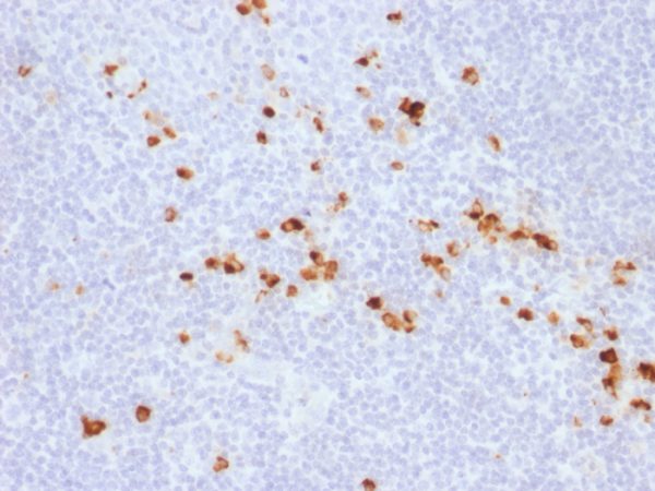 Immunohistochemistry (Formalin/PFA-fixed paraffin-embedded sections) - Anti-IgG antibody [IG507R] (AB218427), expandable thumbnail