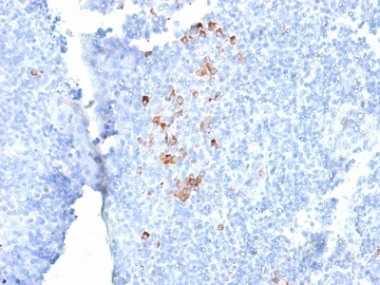 Immunohistochemistry (Formalin/PFA-fixed paraffin-embedded sections) - Anti-IgG antibody [rIG266] (AB238004)