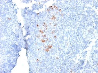 Immunohistochemistry (Formalin/PFA-fixed paraffin-embedded sections) - Anti-IgG antibody [rIG266] (AB238004)