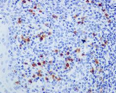 Immunohistochemistry (Formalin/PFA-fixed paraffin-embedded sections) - Anti-IgG2 antibody [EPR4418] (ab134050), expandable thumbnail