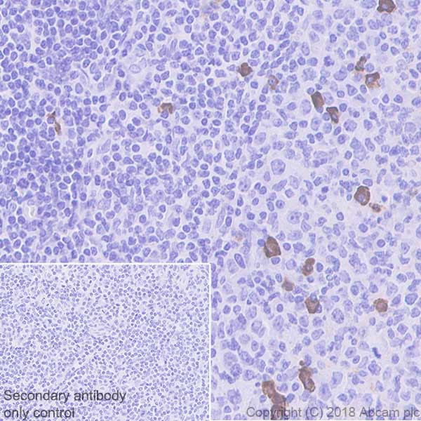 Immunohistochemistry (Formalin/PFA-fixed paraffin-embedded sections) - Anti-IgG2 antibody [EPR4418] (AB134050), expandable thumbnail