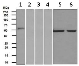 Western blot - Anti-IgG2 antibody [EPR4418] (AB134050), expandable thumbnail