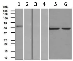 Western blot - Anti-IgG2 antibody [EPR4418] (AB134050)