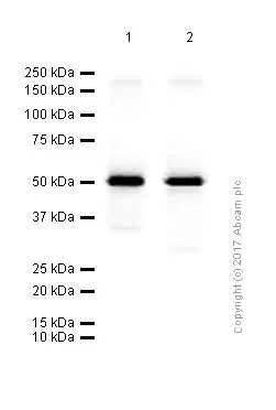 Western blot - Anti-IgG2 antibody [EPR4418] (AB134050)