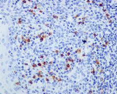 Immunohistochemistry (Formalin/PFA-fixed paraffin-embedded sections) - Anti-IgG2 antibody [EPR4418] - BSA and Azide free (AB186920)