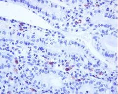 Immunohistochemistry (Formalin/PFA-fixed paraffin-embedded sections) - Anti-IgG2 antibody [EPR4418] - BSA and Azide free (AB186920)