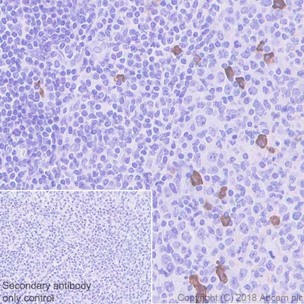 Immunohistochemistry (Formalin/PFA-fixed paraffin-embedded sections) - Anti-IgG2 antibody [EPR4418] - BSA and Azide free (AB186920)