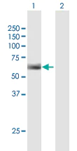 Western blot - Anti-IgG3 antibody (AB169323)