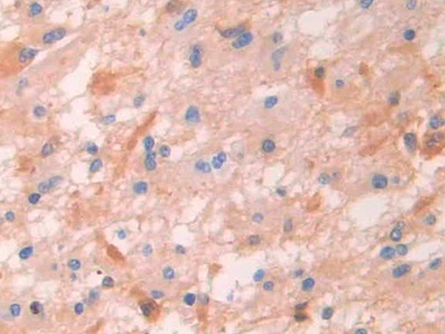 Immunohistochemistry (Formalin/PFA-fixed paraffin-embedded sections) - Anti-IgG4 antibody (AB232869)