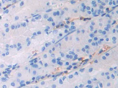 Immunohistochemistry (Formalin/PFA-fixed paraffin-embedded sections) - Anti-IgG4 antibody (AB232869)