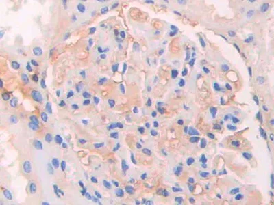 Immunohistochemistry (Formalin/PFA-fixed paraffin-embedded sections) - Anti-IgG4 antibody (AB232869)