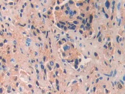 Immunohistochemistry (Formalin/PFA-fixed paraffin-embedded sections) - Anti-IgG4 antibody (AB232869)