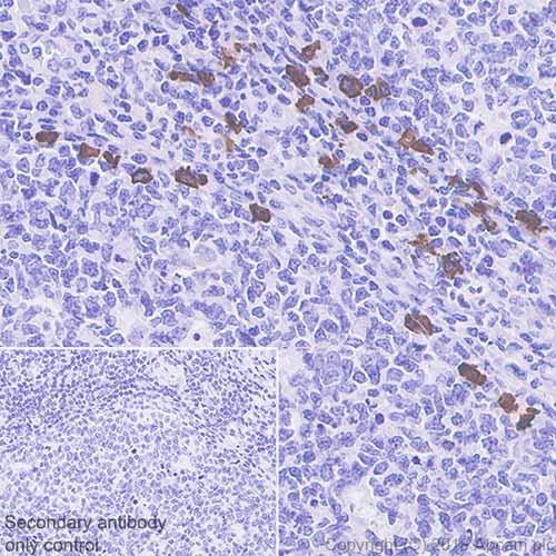 Immunohistochemistry (Formalin/PFA-fixed paraffin-embedded sections) - Anti-IgG4 antibody [EP4420] - BSA and Azide free (AB271883)