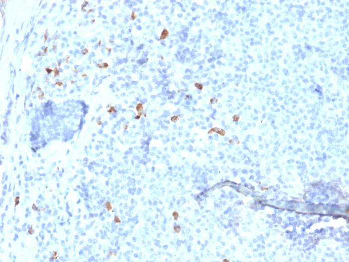 Immunohistochemistry (Formalin/PFA-fixed paraffin-embedded sections) - Anti-IgG4 antibody [IGHG4/1345] (AB218428)