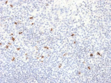 Immunohistochemistry (Formalin/PFA-fixed paraffin-embedded sections) - Anti-IgG4 antibody [IGHG4/2042R] - BSA and Azide free (AB237849)