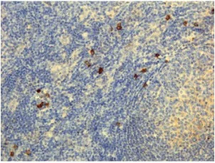 Immunohistochemistry (Formalin/PFA-fixed paraffin-embedded sections) - Anti-IgG4 antibody [RM120] (AB238320)