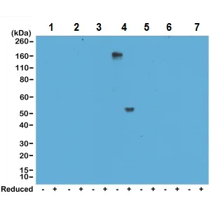 Western blot - Anti-IgG4 antibody [RM120] (AB238320)