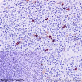 Immunohistochemistry (Formalin/PFA-fixed paraffin-embedded sections) - Anti-IGJ antibody [EPR13794] - BSA and Azide free (AB251139)