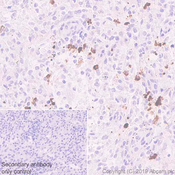 Immunohistochemistry (Formalin/PFA-fixed paraffin-embedded sections) - Anti-IGJ antibody [EPR23130-113] - BSA and Azide free (AB269860)