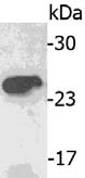 Western blot - Anti-IGJ antibody [KT109] (AB169854)