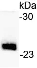 Western blot - Anti-IGJ antibody [KT109] (AB169854)