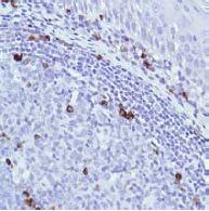 Immunohistochemistry (Formalin/PFA-fixed paraffin-embedded sections) - Anti-IGJ antibody [SP105] (AB105229), expandable thumbnail