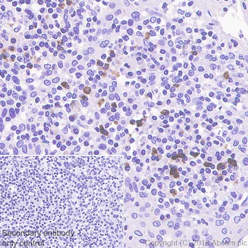 Immunohistochemistry (Formalin/PFA-fixed paraffin-embedded sections) - Anti-IGJ antibody [SP105] (AB105229), expandable thumbnail