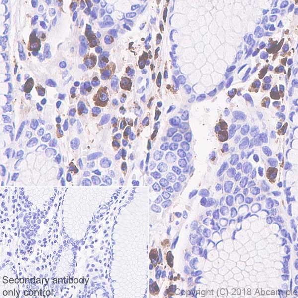 Immunohistochemistry (Formalin/PFA-fixed paraffin-embedded sections) - Anti-IGJ antibody [SP105] (AB105229), expandable thumbnail