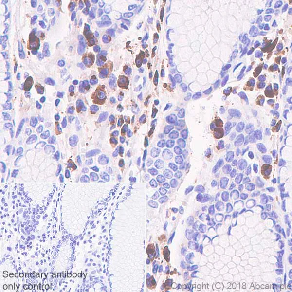 Immunohistochemistry (Formalin/PFA-fixed paraffin-embedded sections) - Anti-IGJ antibody [SP105] (AB105229)