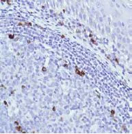 Immunohistochemistry (Formalin/PFA-fixed paraffin-embedded sections) - Anti-IGJ antibody [SP105] - BSA and Azide free (AB240939)