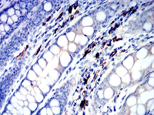 Immunohistochemistry (Formalin/PFA-fixed paraffin-embedded sections) - Anti-IGLC2 antibody [5E12B9] (AB233563)