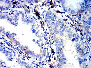 Immunohistochemistry (Formalin/PFA-fixed paraffin-embedded sections) - Anti-IGLC2 antibody [5E12B9] (AB233563)