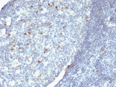 Immunohistochemistry (Formalin/PFA-fixed paraffin-embedded sections) - Anti-IgM antibody [IM260 + IM373 + ICO-30] (AB233887)