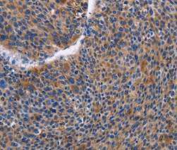 Immunohistochemistry (Formalin/PFA-fixed paraffin-embedded sections) - Anti-IGSF10 antibody (AB197671), expandable thumbnail