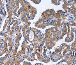 Immunohistochemistry (Formalin/PFA-fixed paraffin-embedded sections) - Anti-IGSF10 antibody (AB197671), expandable thumbnail