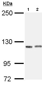 Western blot - Anti-IGSF3 antibody (AB97704), expandable thumbnail