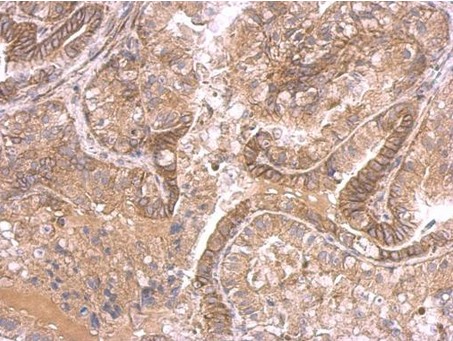 Immunohistochemistry (Formalin/PFA-fixed paraffin-embedded sections) - Anti-Ihh antibody (AB184624)