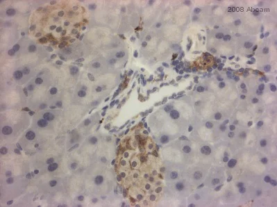 Immunohistochemistry (Formalin/PFA-fixed paraffin-embedded sections) - Anti-Ihh antibody (AB39634)