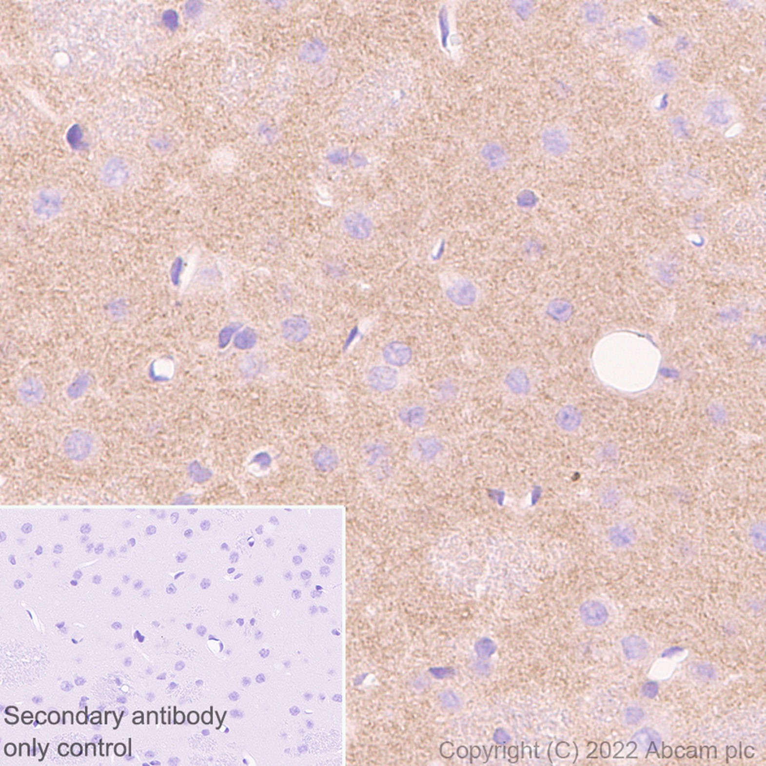 Anti-Ihh antibody [EP1192Y] (ab52919) | Abcam