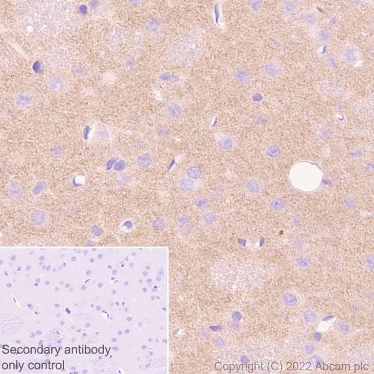 Immunohistochemistry (Formalin/PFA-fixed paraffin-embedded sections) - Anti-Ihh antibody [EP1192Y] - BSA and Azide free (AB239853)