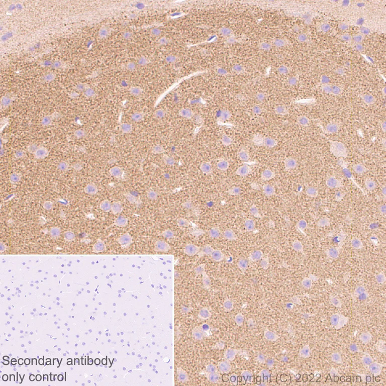Immunohistochemistry (Formalin/PFA-fixed paraffin-embedded sections) - Anti-Ihh antibody [EP1192Y] - BSA and Azide free (AB239853)