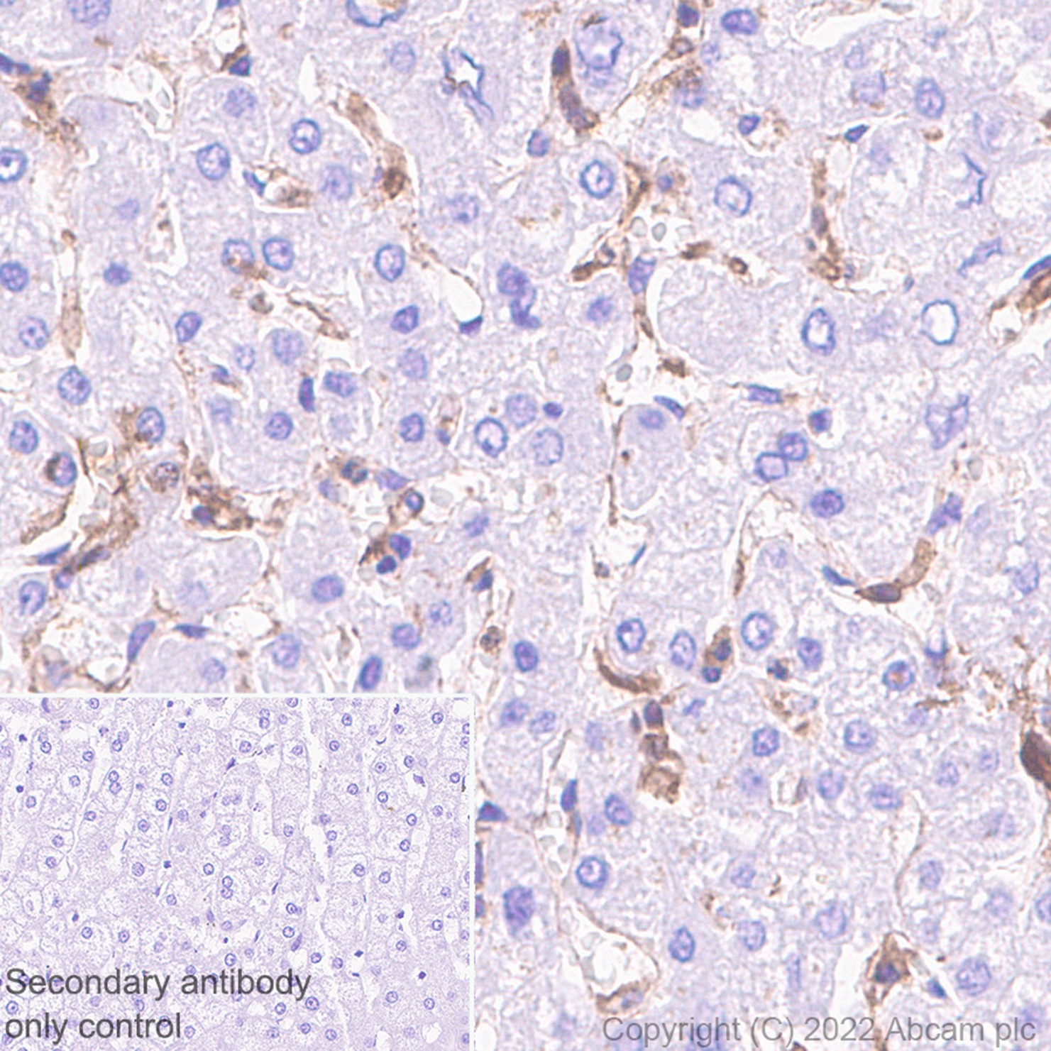 Immunohistochemistry (Formalin/PFA-fixed paraffin-embedded sections) - Anti-Ihh antibody [EP1192Y] - BSA and Azide free (AB239853)
