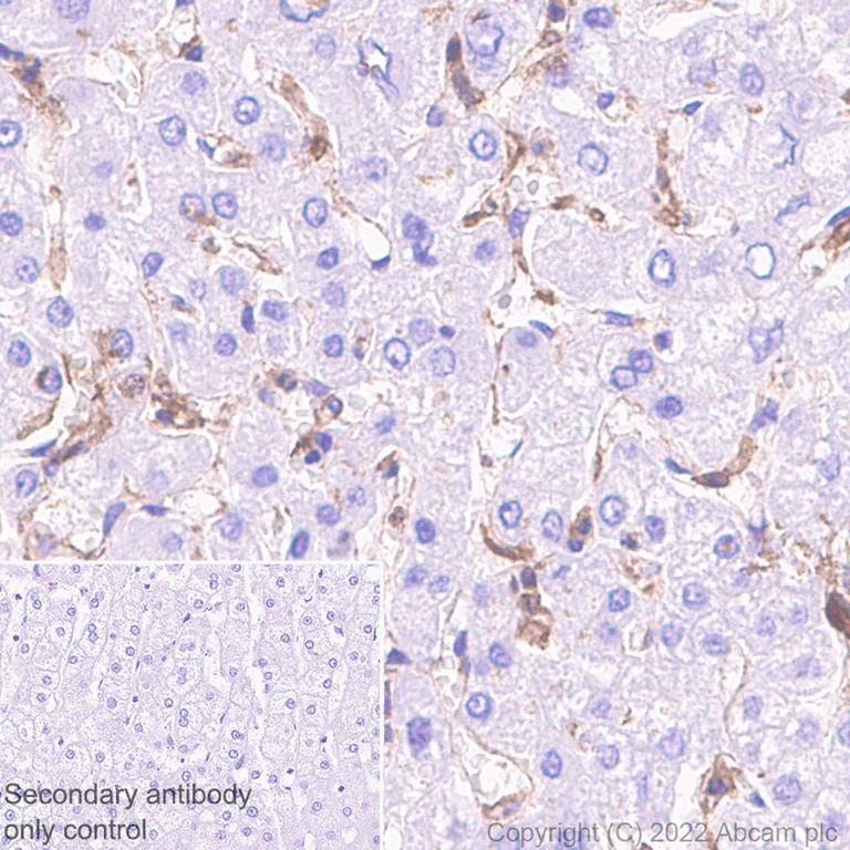 Immunohistochemistry (Formalin/PFA-fixed paraffin-embedded sections) - Anti-Ihh antibody [EP1192Y] - BSA and Azide free (AB239853)