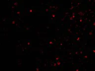 Immunocytochemistry/ Immunofluorescence - Anti-IKAP/p150 antibody (AB62498)