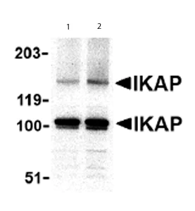 Western blot - Anti-IKAP/p150 antibody (AB62498)