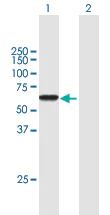 Western blot - Anti-Ikaros antibody (AB168757)